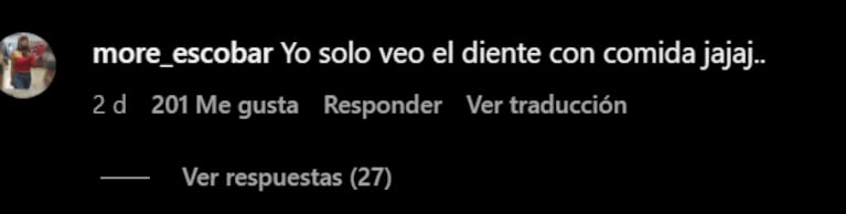 A Coti la acusaron de tener comida en un diente. Foto: Santiago Balmaceda.