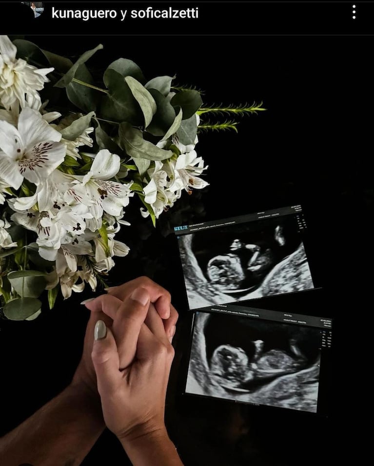 Así anunciaban el Kun Agüero y Sofía Calzetti que estaban esperando su primer hijo juntos.