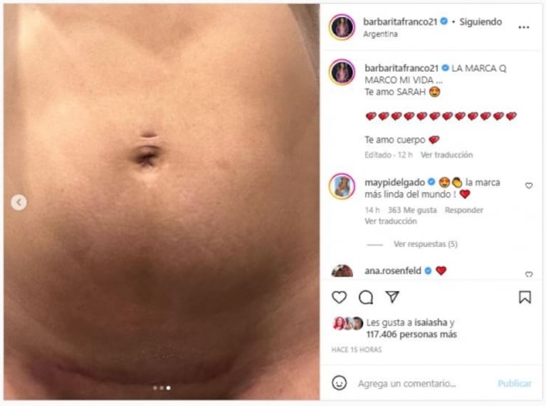 Barby Franco mostró la cicatriz de su cesárea y recibió un aluvión de felicitaciones