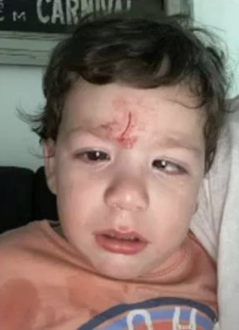 Belu Lucius contó que su hijo sufrió un doloroso accidente: "Yo temblaba del miedo y le dieron nueve puntos en la frente"