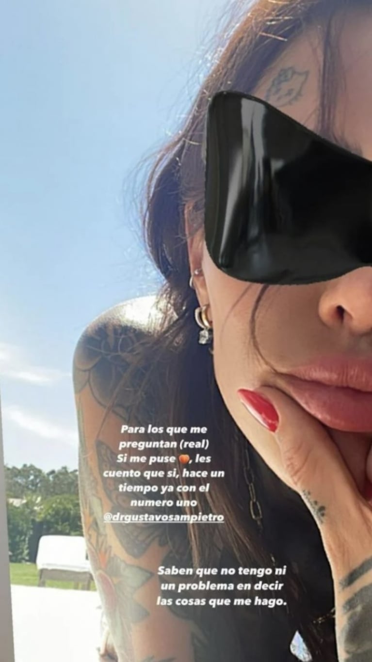 Cande Tinelli reveló la última cirugía estética que se hizo: "Sí, me puse" 