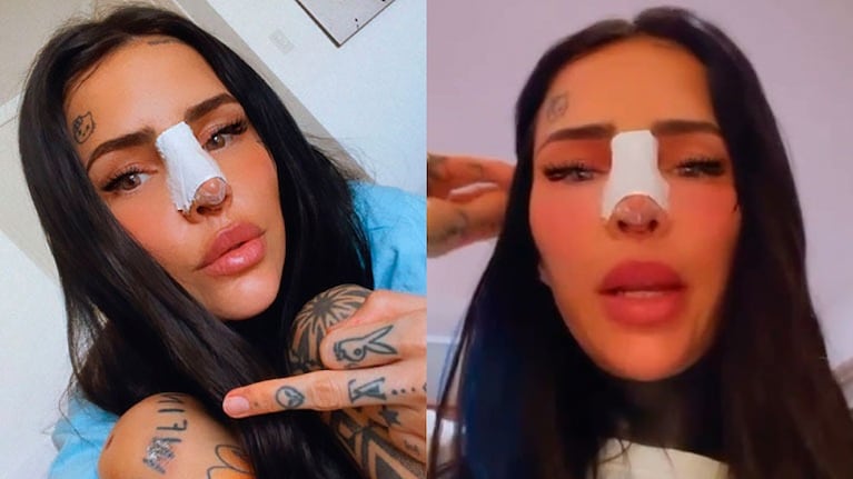 Cande Tinelli reveló que se hizo una cirugía estética en la nariz: Me hice una rinoplastía correccional