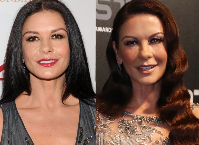 ¿Catherine Zeta-Jones se sometió a alguna cirugía plástica?