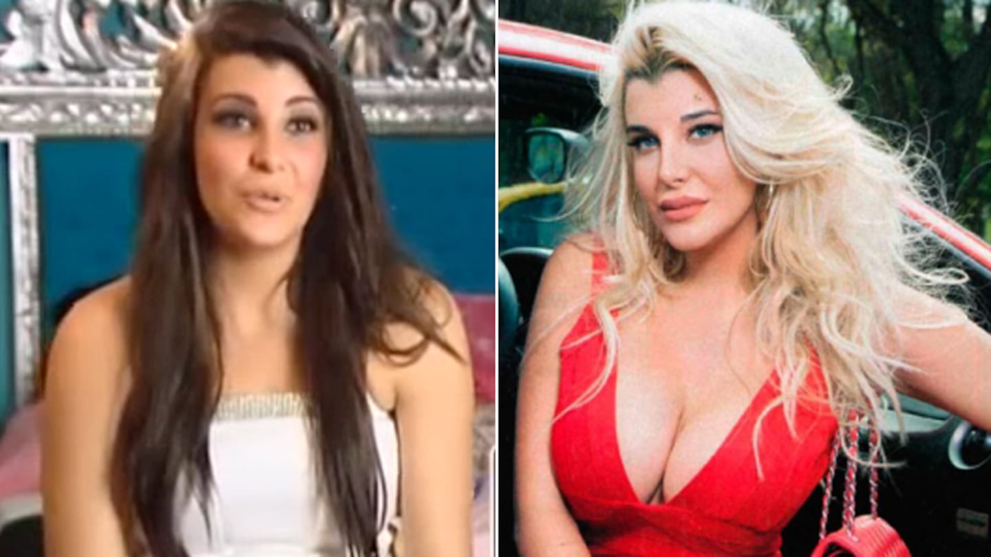 Charlotte Caniggia detalló las cuatro cirugías que se hizo: 