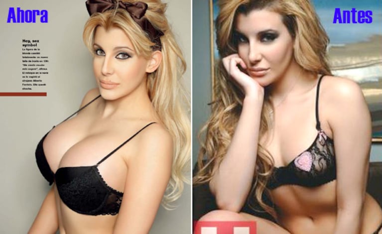 Charlotte Caniggia, antes y después de su operación de lolas y nariz. (Fotos: Gente y Hombre)