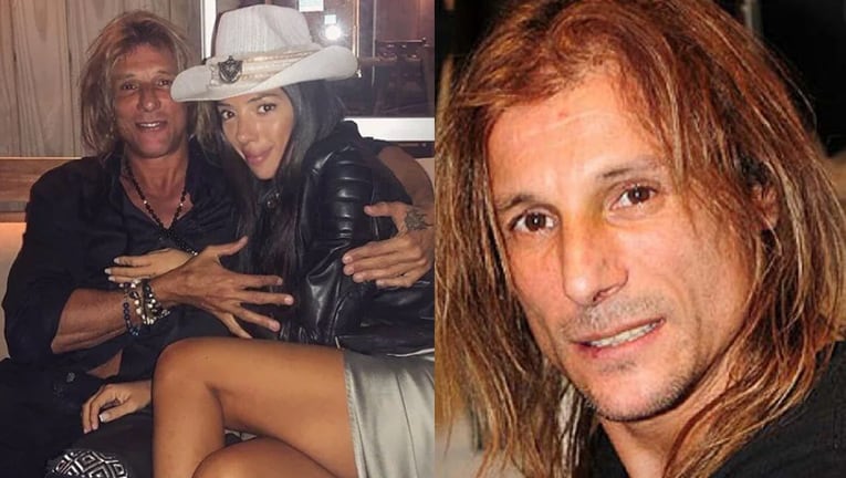 Claudio Caniggia se hizo un tratamiento estético a pedido de su novia.