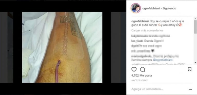 El emotivo mensaje del Ogro Fabbiani a tres años de superar un cáncer