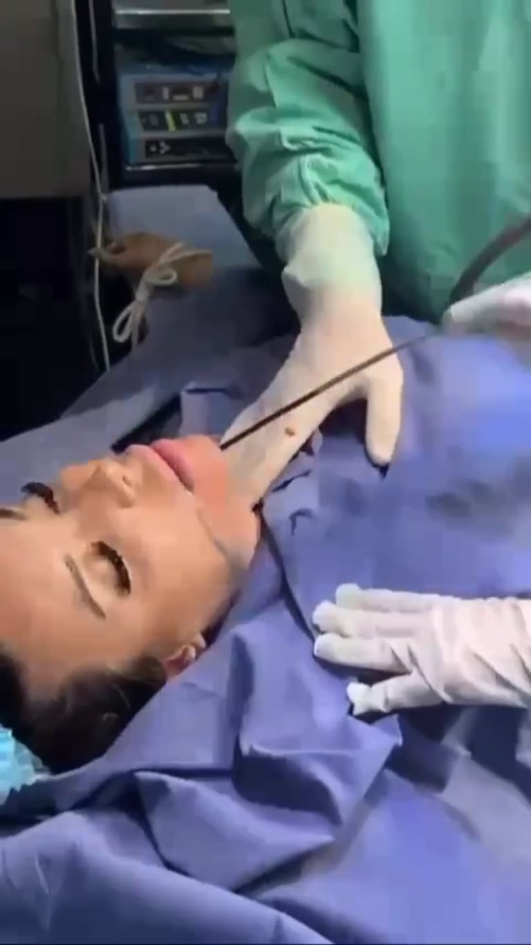 El impactante video de Charlotte Caniggia en el quirófano haciéndose una cirugía estética