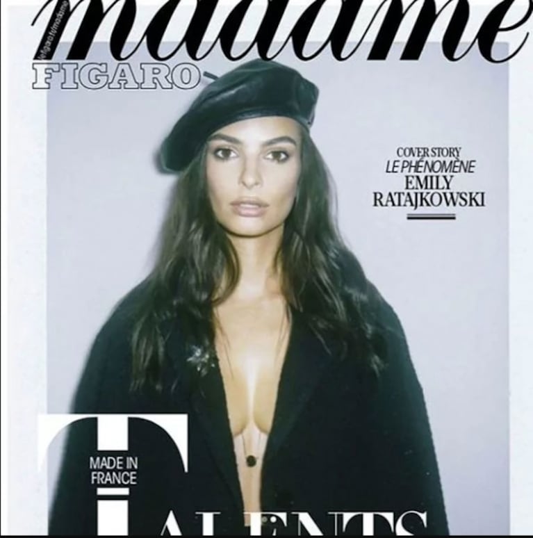 Emily Ratajkowski, indignada con una revista por el excesivo retoque digital en sus labios y lolas