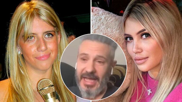 Un cirujano desmintió a Wanda Nara y detalló cuáles son las cirugías estéticas que se hizo la mediática