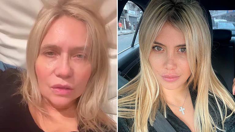 El “reto” de la mamá de Wanda Nara por publicar fotos de sus seres queridos lastimados