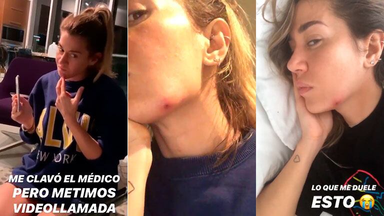 A Jimena Barón se le infectó un grano e hizo una videollamada con el médico