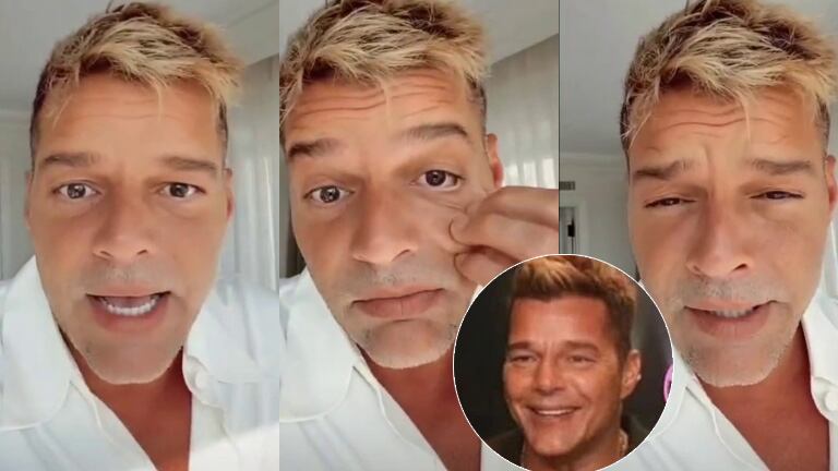 Ricky Martin y un contundente descargo tras las críticas por su rostro: "Me inflamé después de ponerme un suero multivitamínico" 