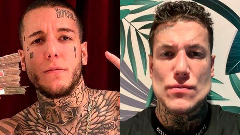 Alex Caniggia se hizo una intervención quirúrgica en el rostro y lo compartió en sus redes