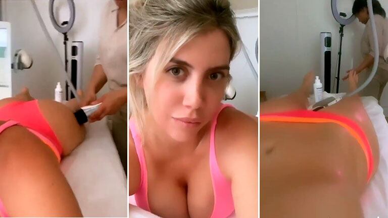 El video de Wanda Nara en plena sesión de radiofrecuencia