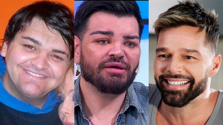 Fran Mariano contó los detalles de las cirugías que se hizo para parecerse a Ricky Martin