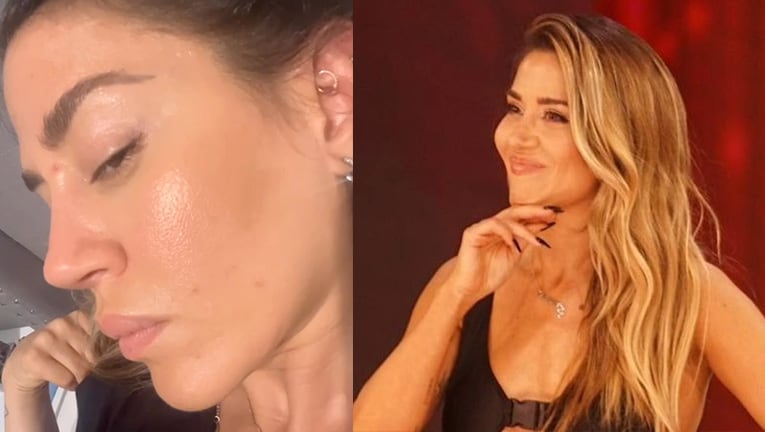 Jimena Barón hizo detox y se quejó porque le empeoró la piel.