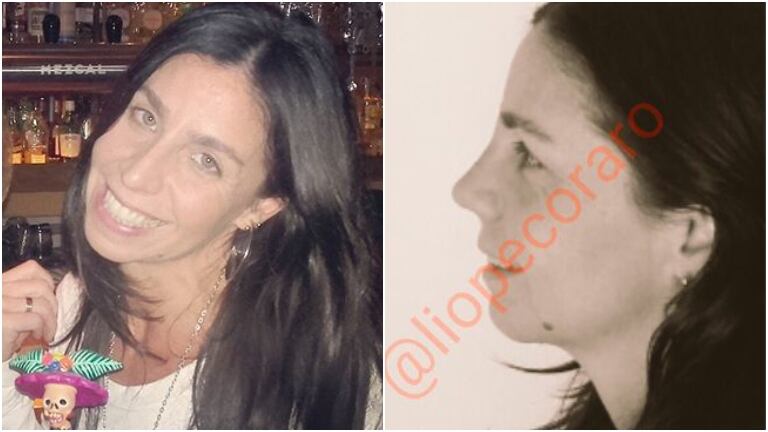 Julieta Bal pasó por el quirófano y se hizo la nariz: sus fotos del antes y después