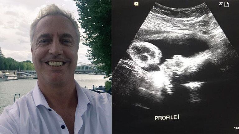 La ecografía del hijo de Marley en la semana 34 de gestación. (Foto: Instagram)