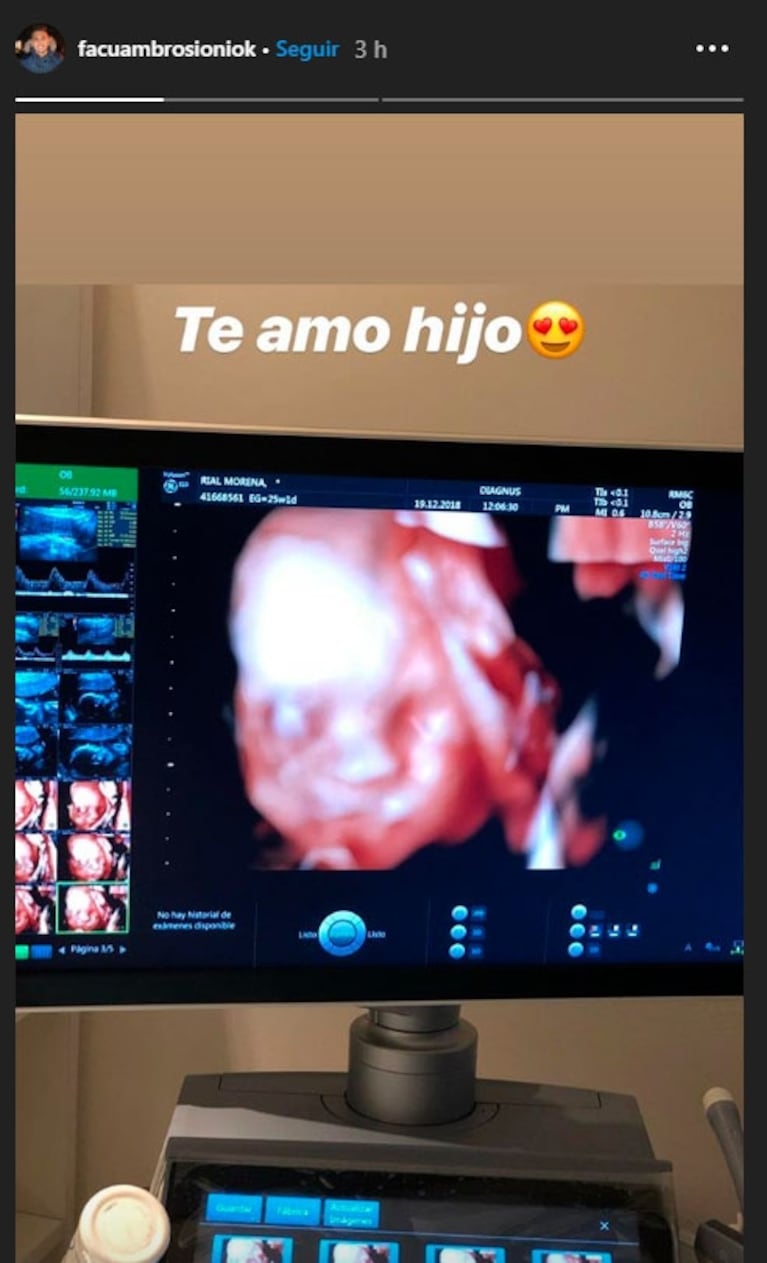 La foto de Morena Rial, embarazada de seis meses, junto a Facundo Ambrosioni: "Hijo mío, te amamos tanto"