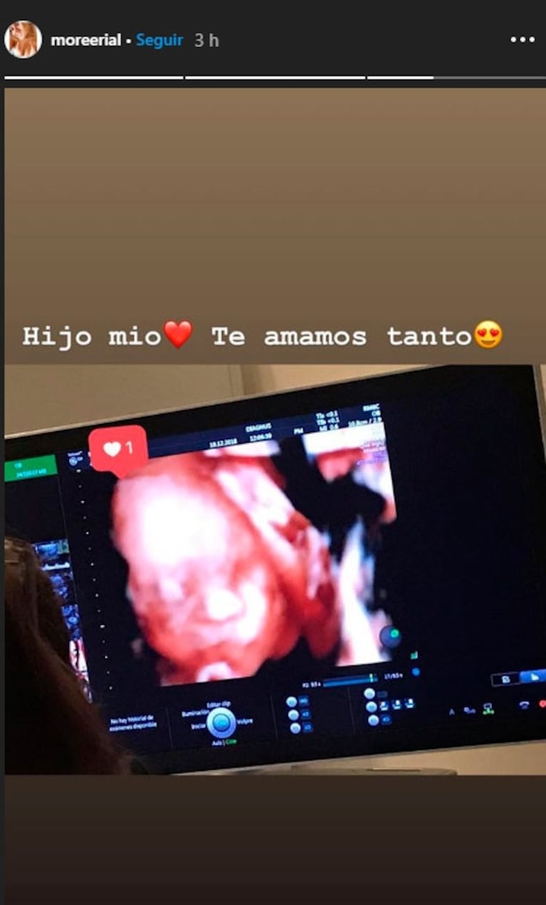 La foto de Morena Rial, embarazada de seis meses, junto a Facundo Ambrosioni: "Hijo mío, te amamos tanto"