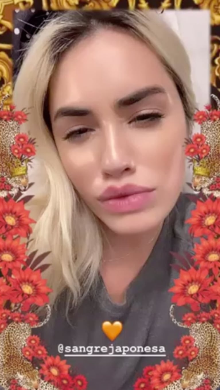 Lali Espósito probó el filtro de China Suárez, que achina los ojos y engrosa los labios, y así quedó: "Sorry"