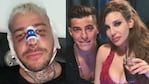 Lhoan, el ex de Charlotte Caniggia, habló de sus cirugías estéticas.