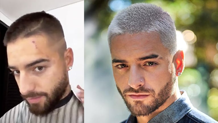 Maluma mostró cómo quedó su rostro tras un inesperado ataque de su perra Buda.