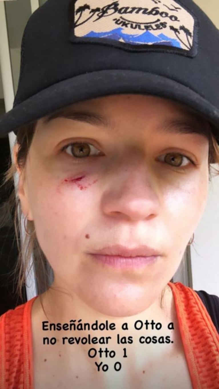 Marcela Kloosterboer mostró su cara, tras un accidente con su hijo: "Enseñándole a Otto a no revolear"