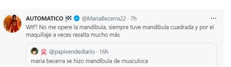 María Becerra reaccionó picante cuando afirmaron que se operó la mandíbula