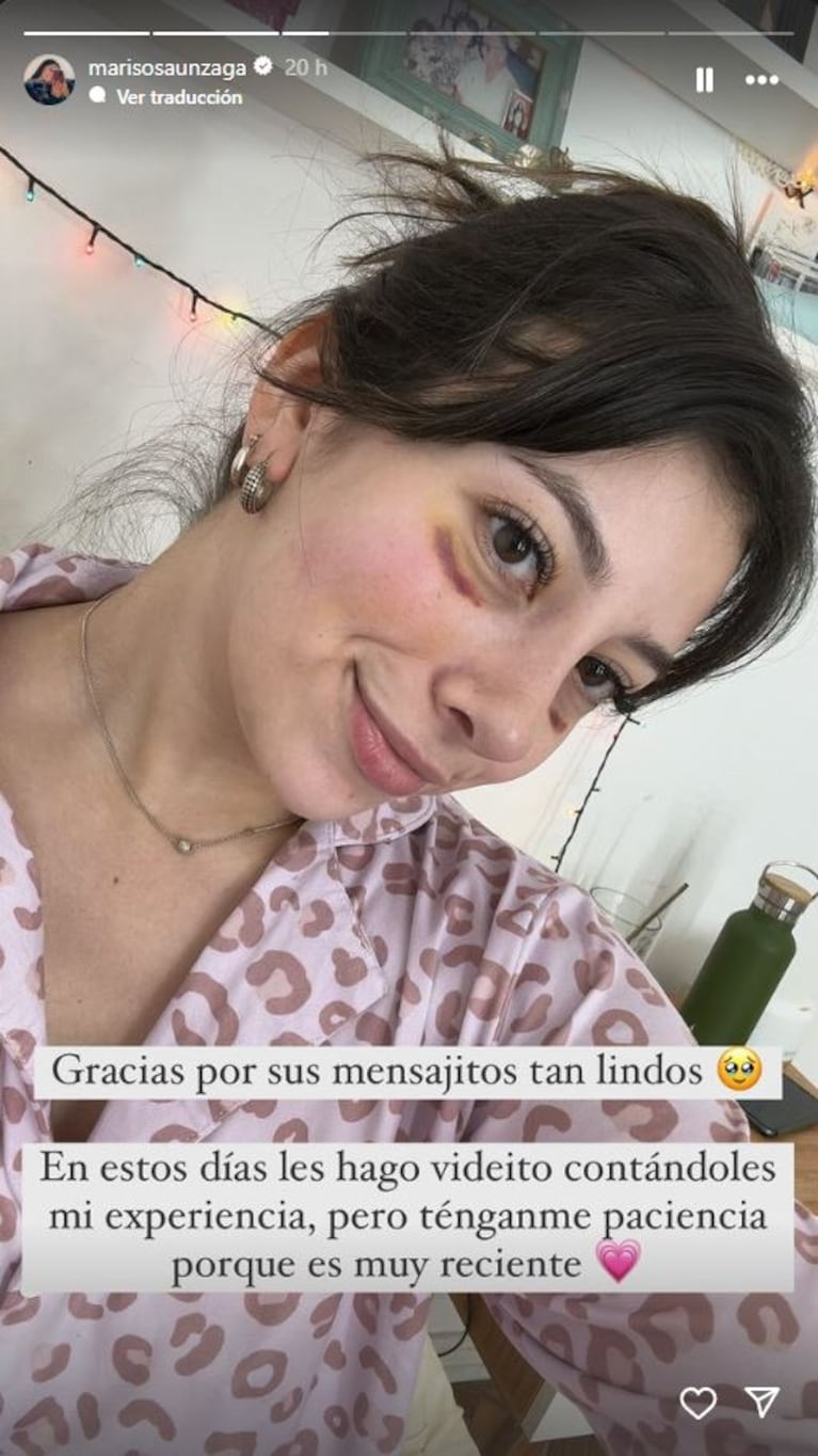 Marisol anunció que se realizó una rinoplastia en medio de su proceso de recuperación y las redes sociales estallaron. (Foto: Instagram / marisosaunzaga)