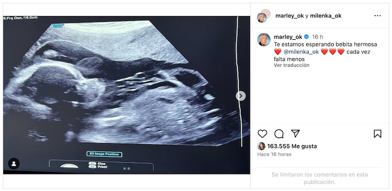 Marley mostró la primera imagen de Milenka (Foto: IG @marley_ok)