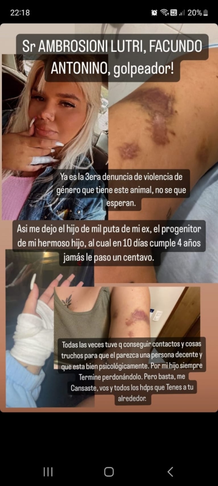 Morena Rial dijo haber sido víctima de violencia de género, acusó al padre de su hijo y compartió pruebas