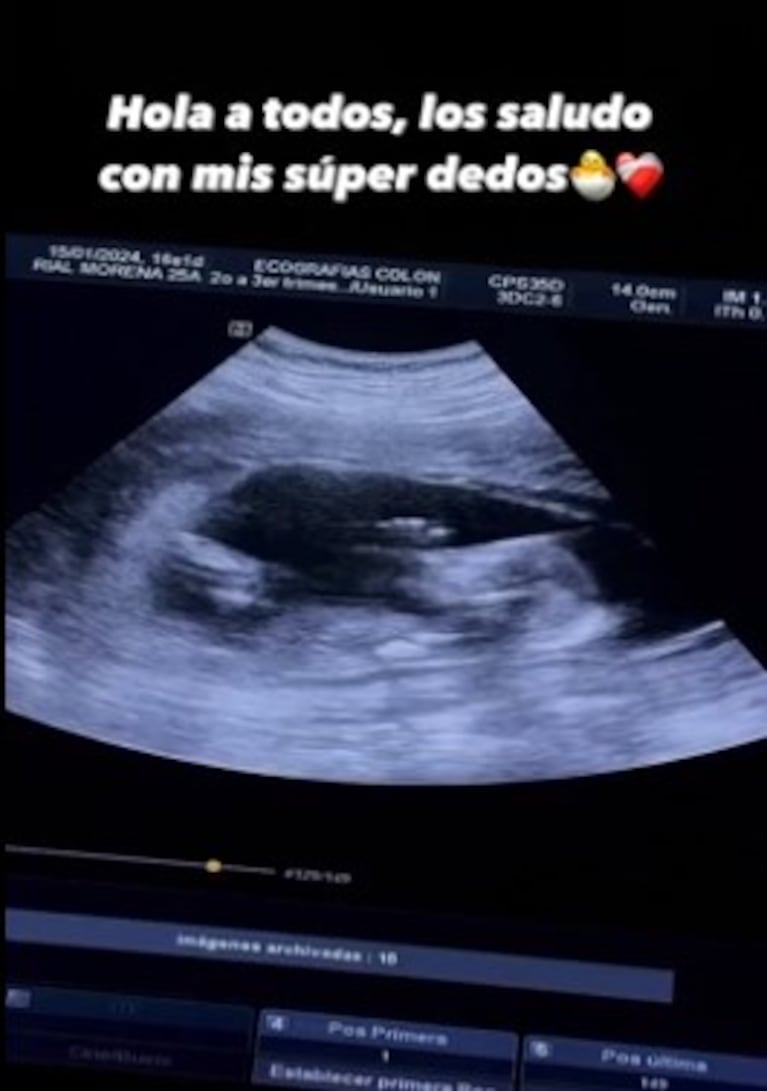 Morena Rial mostró la primera ecografía de su bebé: “Súper dedos”