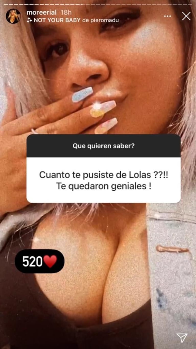 Morena Rial reveló que se agregó 520 centímetros cúbicos en las lolas: "Quedaron geniales"