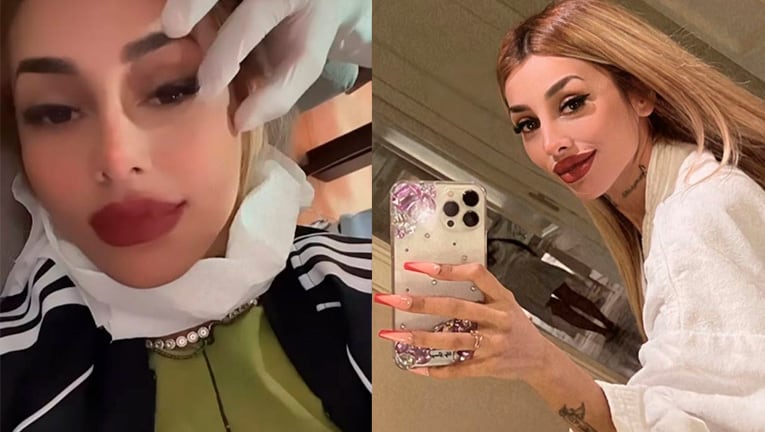 Tamara Báez se hizo un piercing microdermal en la mejilla.