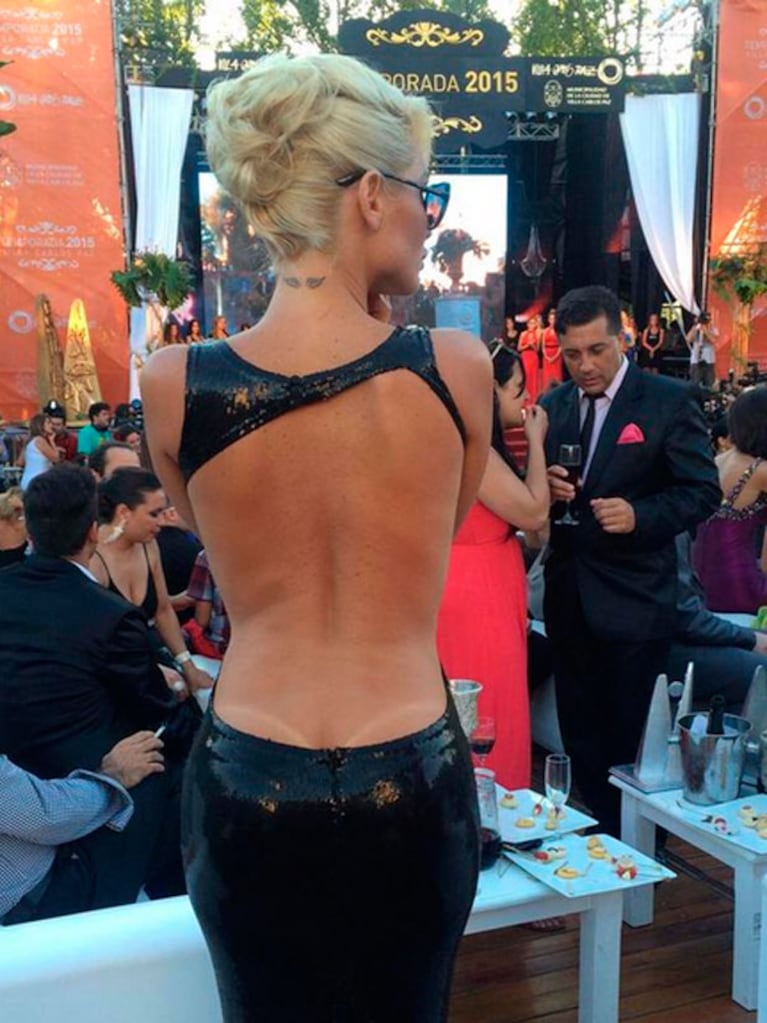 Vicky Xipolitakis mostró con orgullo la marca que le dejó el sol en la espalda. (Foto: Twitter)