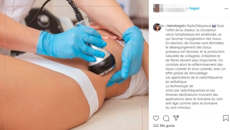 Wanda Nara mostró su sesión de radiofrecuencia, en un moderno y lujoso centro estético en Francia