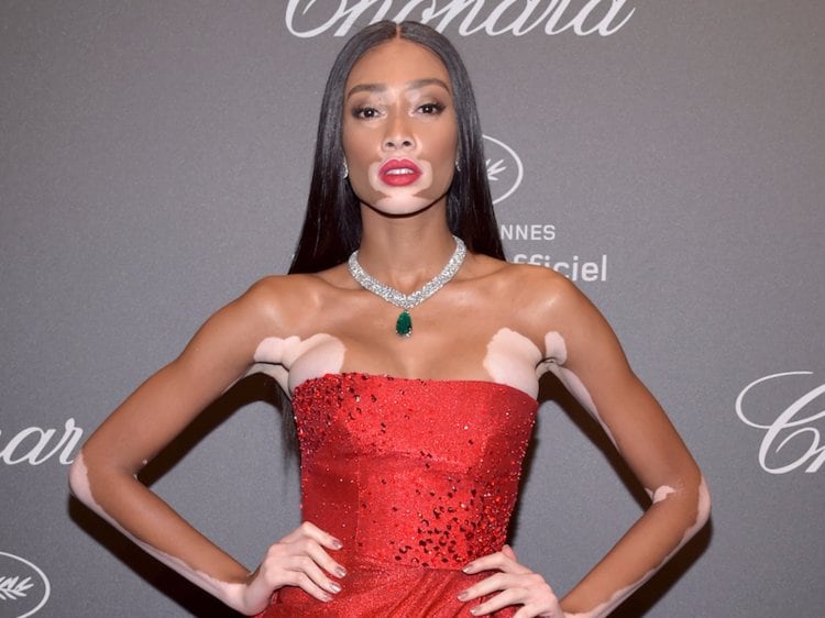 Winnie Harlow: “A veces es complicado lidiar con la fama”