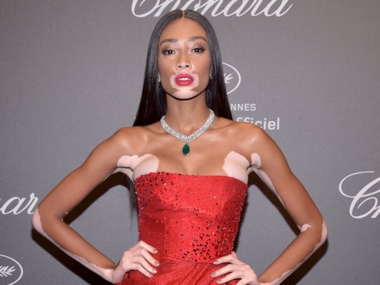 Winnie Harlow: “A veces es complicado lidiar con la fama”